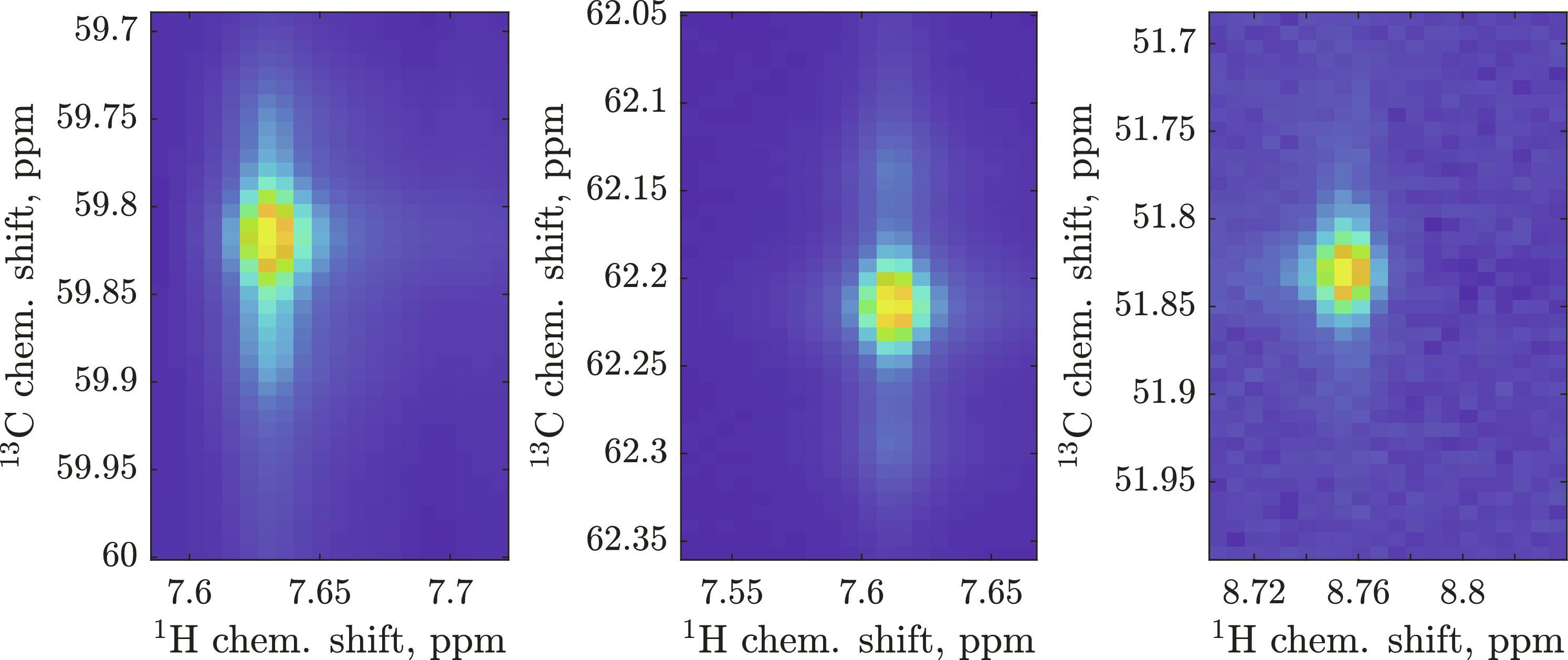 Protein NMR assignment by isotope pattern recognition