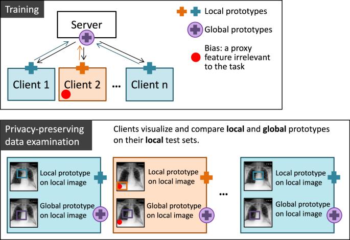 MyThisYourThat for interpretable identification of systematic bias in federated learning for biomedical images