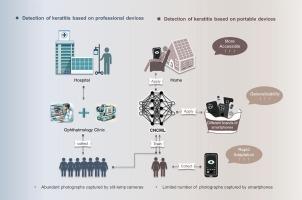 Promoting smartphone-based keratitis screening using meta-learning: A multicenter study