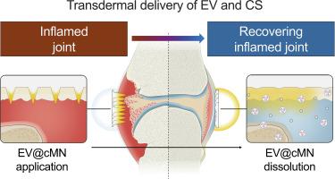 Chondroitin sulfate-based microneedles for transdermal delivery of stem cell-derived extracellular vesicles to treat rheumatoid arthritis