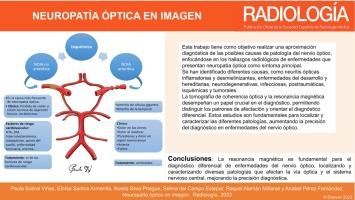 Neuropatía óptica en imagen