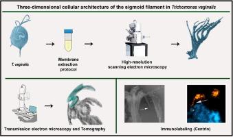 Three-dimensional cellular architecture of the sigmoid filament in Trichomonas vaginalis