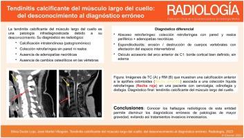 Tendinitis calcificante del músculo largo del cuello: del desconocimiento al diagnóstico erróneo