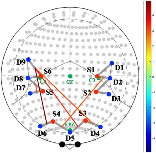 Greater Frontoparietal Connectivity During Task Engagement Among Toddlers With Parent-Reported Inattention