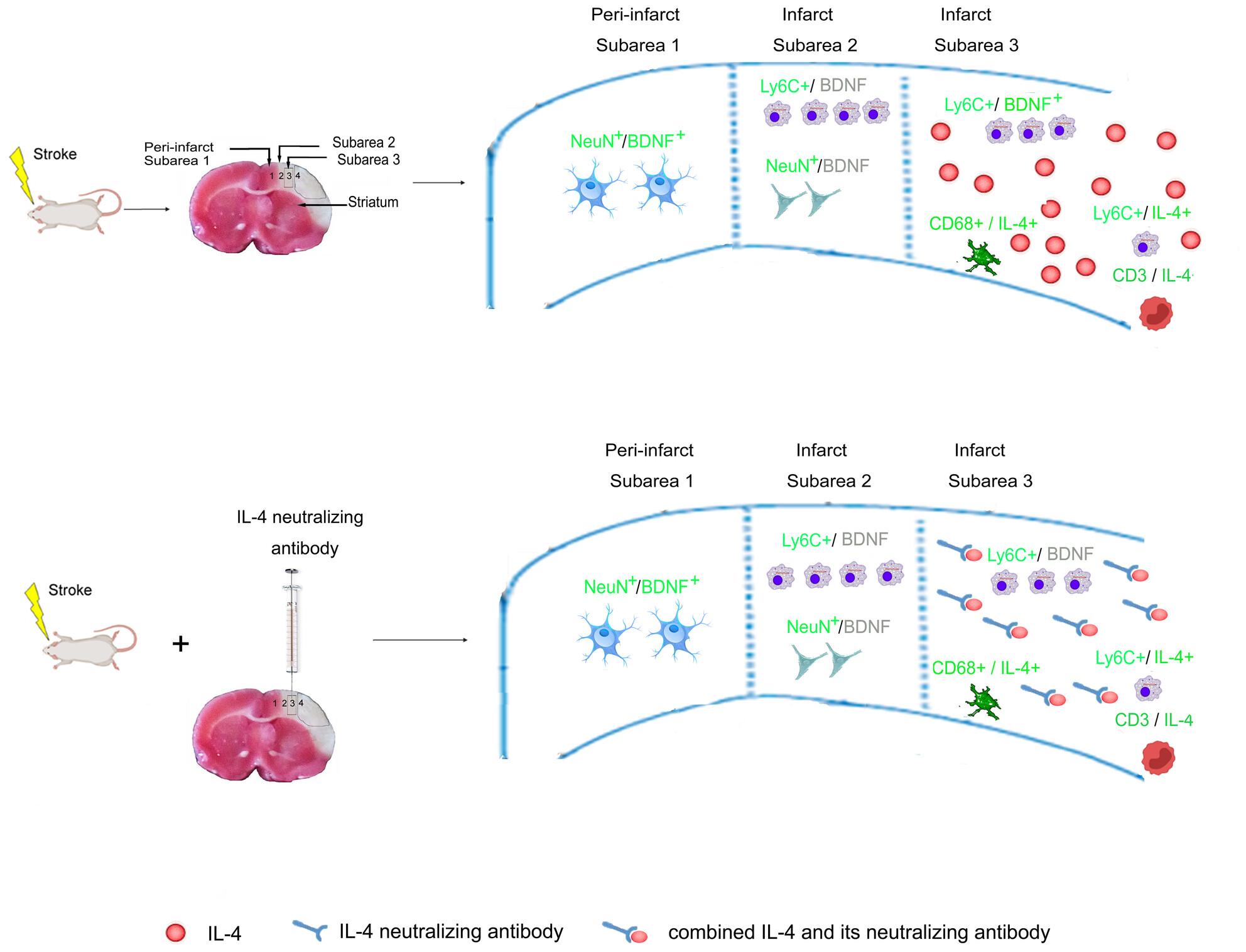 Immune Cells Promote BDNF Expression by Infiltrated Macrophages via Interleukin 4 in the Cerebral Ischemia of Male Rats