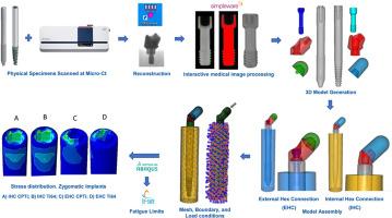 Influence of connection design and material properties on stress distribution and fatigue lifetime of zygomatic implants: A finite element analysis