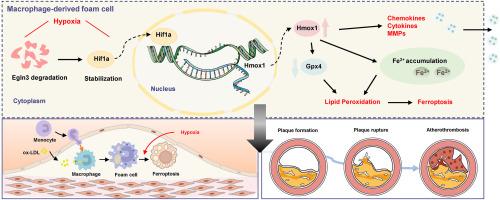 High expression levels of haem oxygenase-1 promote ferroptosis in macrophage-derived foam cells and exacerbate plaque instability