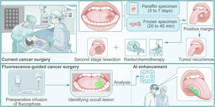 Illuminating the future of precision cancer surgery with fluorescence imaging and artificial intelligence convergence