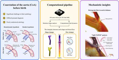 The onset of coarctation of the aorta before birth: Mechanistic insights from fetal arch anatomy and haemodynamics