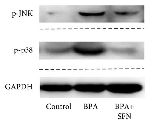 Sulforaphane Alleviates Bisphenol A-Induced Glucose Intolerance via Improving Inflammation and Oxidative Stress