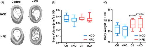 Hdac3 deficiency limits periosteal reaction associated with Western diet feeding in female mice