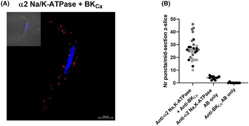 Vascular smooth muscle BK channels limit ouabain-induced vasocontraction: Dual role of the Na/K-ATPase as a hub for Src-kinase and the Na/Ca-exchanger