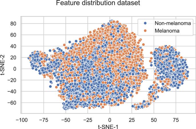 Prospective multicenter study using artificial intelligence to improve dermoscopic melanoma diagnosis in patient care