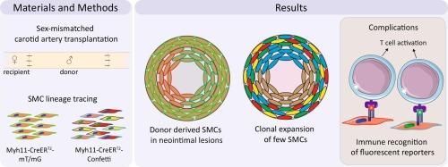 Smooth muscle cells clonally expand in a murine carotid allograft model complicated by immune reactions to reporter transgenes