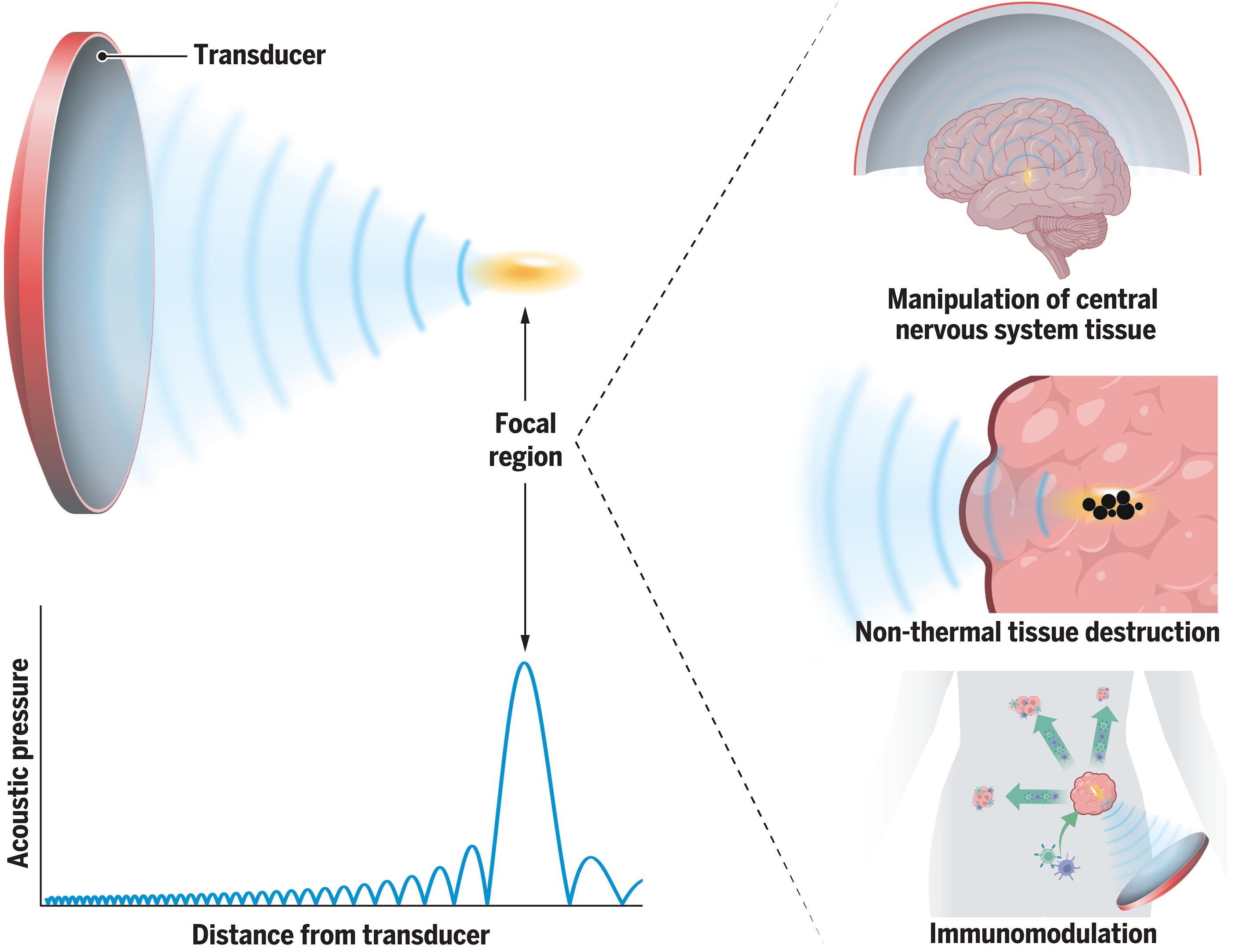 Exploiting the mechanical effects of ultrasound for noninvasive therapy