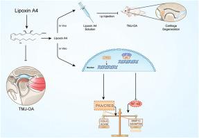 Lipoxin A4 modulates the PKA/CREB and NF-κB signaling pathway to mitigate chondrocyte catabolism and apoptosis in temporomandibular joint osteoarthritis