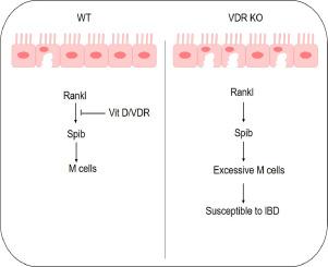 Intestinal epithelial vitamin D receptor defense against inflammatory bowel disease via regulating microfold cells