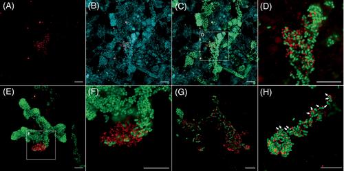 Unique episymbiotic relationship between Candidatus Patescibacteria and Zoogloea in activated sludge flocs at a municipal wastewater treatment plant