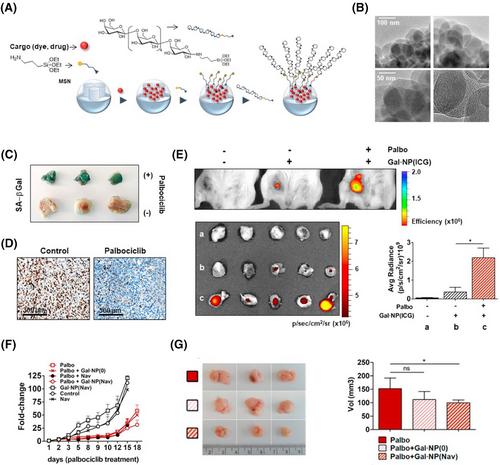 Targeting senescence-associated secretory phenotypes to remodel the tumour microenvironment and modulate tumour outcomes