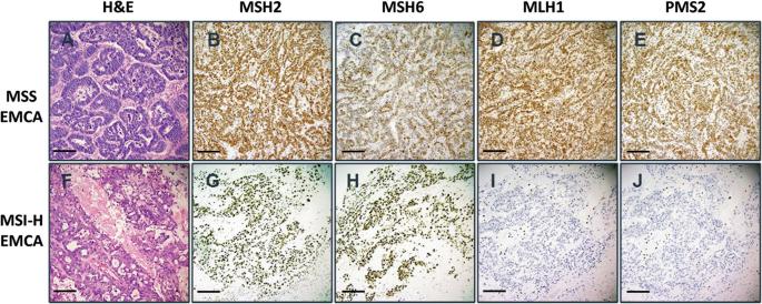 Pan-tumor validation of a NGS fraction-based MSI analysis as a predictor of response to Pembrolizumab