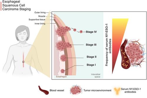 NY-ESO-1 antigen: A promising frontier in cancer immunotherapy