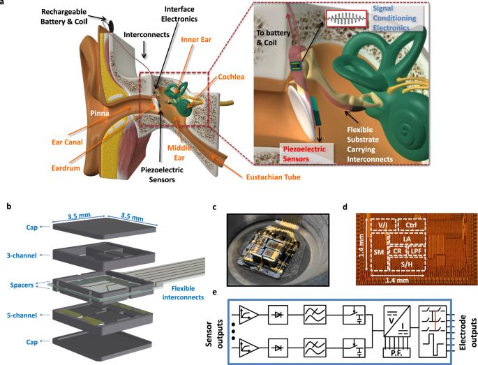 A full-custom fully implantable cochlear implant system validated in vivo with an animal model