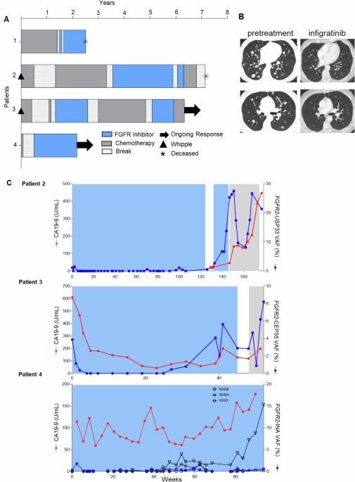 FGFR2-fusions define a clinically actionable molecular subset of pancreatic cancer