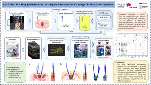 SafeRPlan: Safe deep reinforcement learning for intraoperative planning of pedicle screw placement