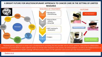 A bright future for multidisciplinary approach to cancer care in the setting of limited resource