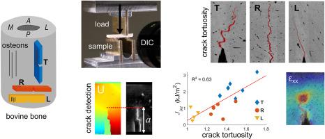 Characterization of damage mechanisms in cortical bone: Quantification of fracture resistance, critical strains, and crack tortuosity