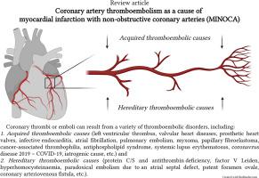 Coronary artery thromboembolism as a cause of myocardial infarction with non-obstructive coronary arteries (MINOCA)