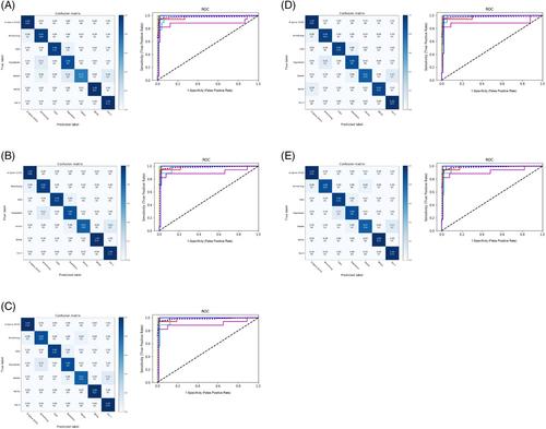 Development and validation of deep learning models for identifying the brand of pedicle screws on plain spine radiographs