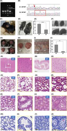 A novel homozygous mutation in the DNAAF3 gene leads to severe asthenozoospermia and teratospermia