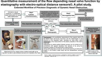 Quantitative measurement of the flow depending nasal valve function by elastography with electro-optical distance sensors. A pilot study