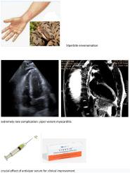 Venom-induced myocarditis: An unusual case attributable to Vipera aspis bite