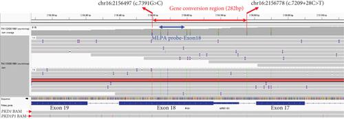 Long-Read Sequencing Identified a PKD1 Gene Conversion in ADPKD Rather Than the False-Positive Exon Deletion Indicated by WES and MLPA