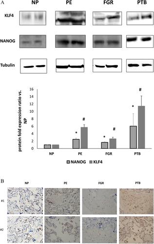 Is the Transcription Factor NANOG Involved in Placental Aging?