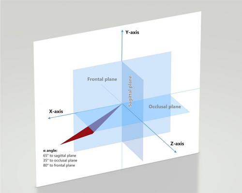 Effect of Needle Insertion Angle on Pain During Labial Infiltration Anesthesia of the Anterior Maxilla: A Randomized Clinical Trial