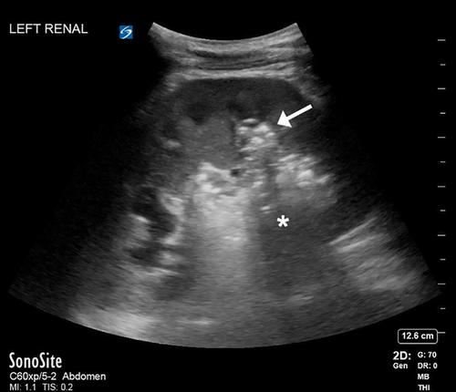 A young man with flank pain and dysuria