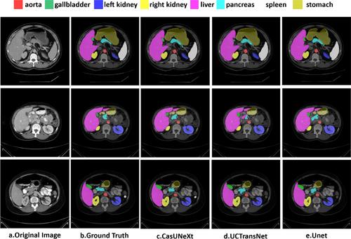 CasUNeXt: A Cascaded Transformer With Intra- and Inter-Scale Information for Medical Image Segmentation