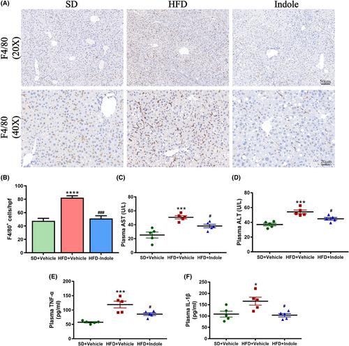 Indole alleviates nonalcoholic fatty liver disease in an ACE2-dependent manner