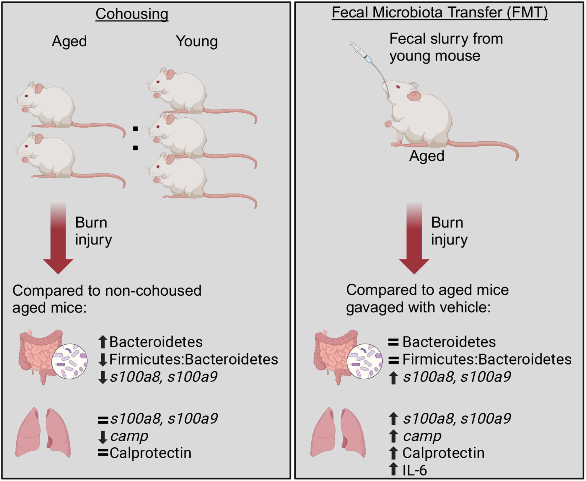 Reducing the excessive inflammation after burn injury in aged mice by maintaining a healthier intestinal microbiome