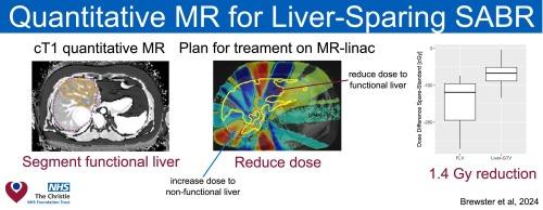 Feasibility of using contrast-free quantitative magnetic resonance imaging for liver sparing stereotactic ablative body radiotherapy