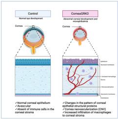 Glucocorticoid Receptor Signaling Is Critical for Mouse Corneal Development, Inhibition of Inflammatory Response, and Neovascularization of the Cornea