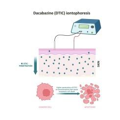 Effect of iontophoresis on dacarbazine cutaneous delivery for melanoma topical treatment