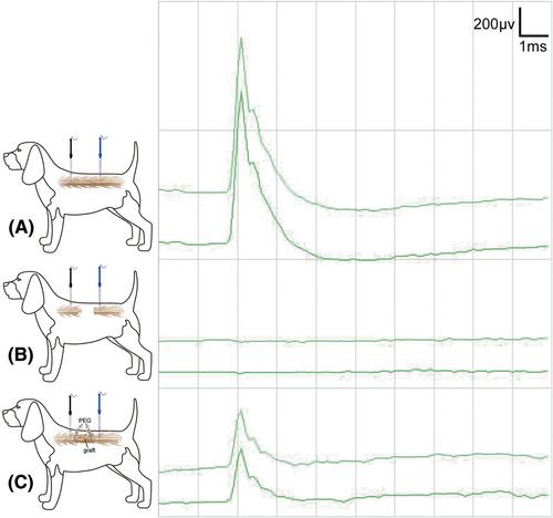 A novel strategy for spinal cord reconstruction via vascularized allogeneic spinal cord transplantation combine spinal cord fusion