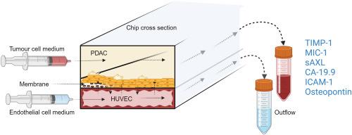 Personalized PDAC chip with functional endothelial barrier for tumour biomarker detection: A platform for precision medicine applications