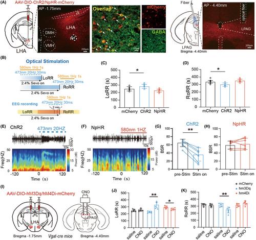 A hypothalamus-lateral periaqueductal gray GABAergic neural projection facilitates arousal following sevoflurane anesthesia in mice