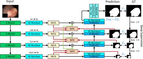 CafeNet: A Novel Multi-Scale Context Aggregation and Multi-Level Foreground Enhancement Network for Polyp Segmentation