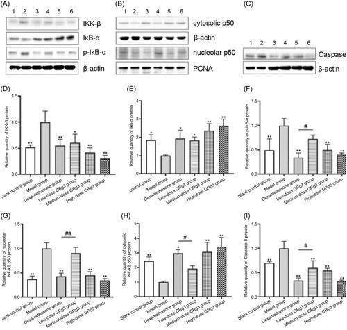 Efficacy and mechanism of action of ginsenoside Rg3 on radiation proctitis in rats